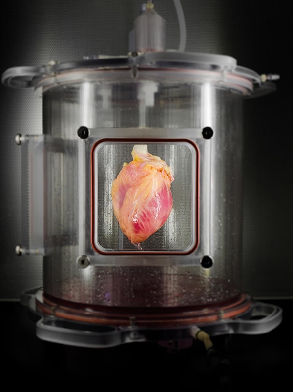 Full-sized human heart grown from stem cells