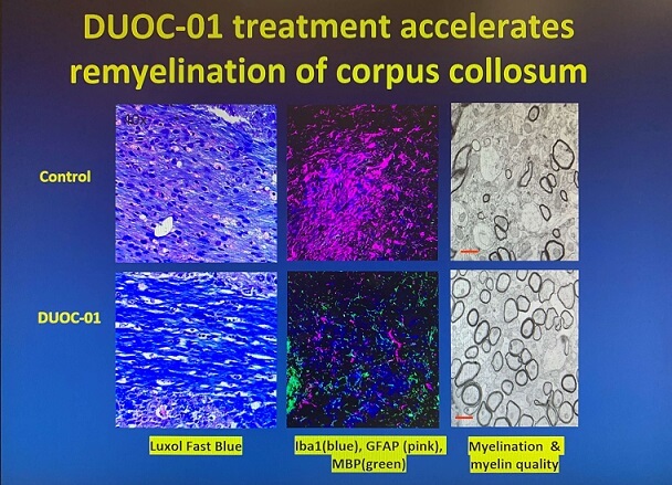 DUOC-01 Results Slide