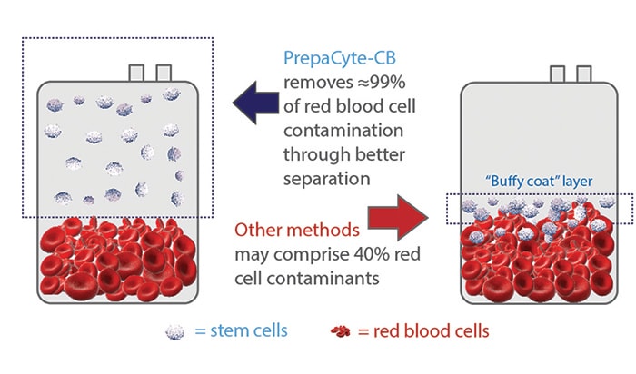 cord blood processing difference