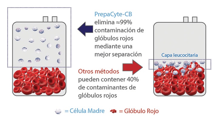 cord blood processing difference