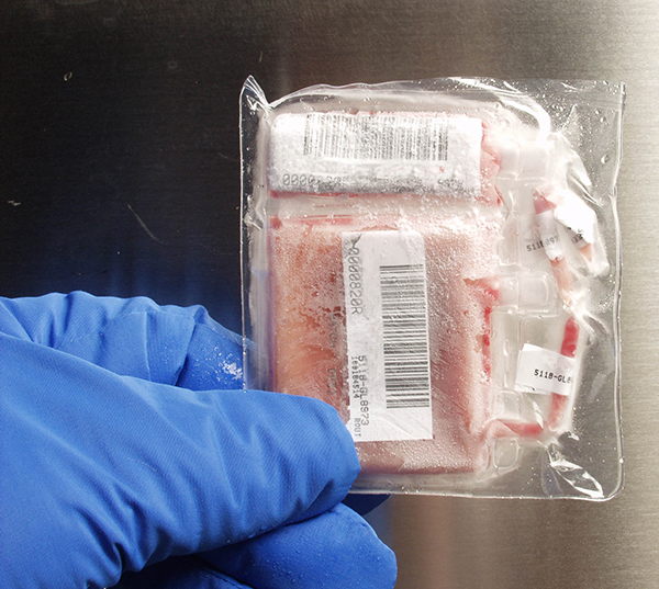 Frozen cord blood unit