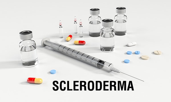 Stem Cells Better Treat Scleroderma