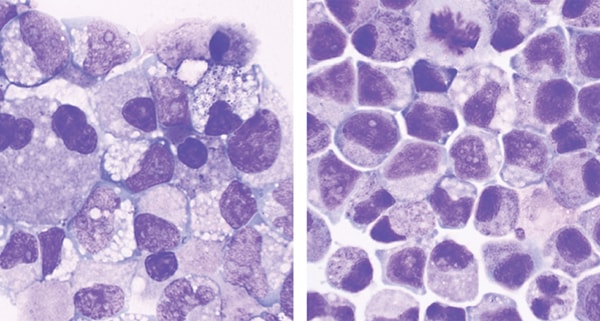 UM171-Expanded cells