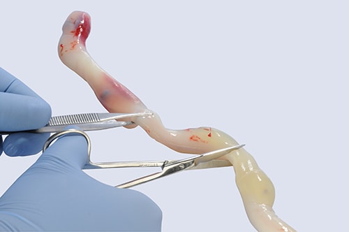 Umbilical cord being cut