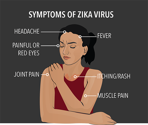 The Zika Virus Risk & Cord Blood Banking