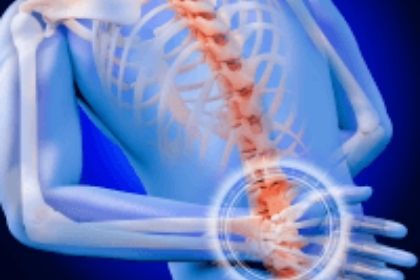 UC-MSCs Are Explored For Treatment of Spine Conditions