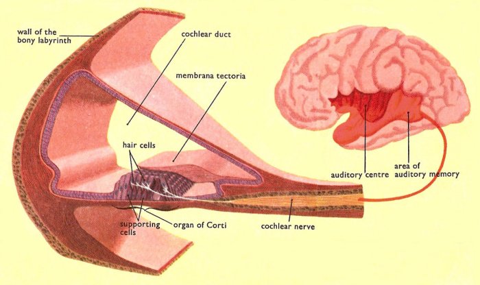 Umbilical Cord Blood Stem Cells to Treat Acquired Hearing Loss in Kids